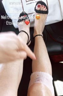 Elisabetta Franchi feet photo thumbnail
