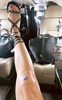 Elisabetta Franchi feet photo thumbnail