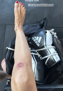 Elisabetta Franchi feet photo thumbnail