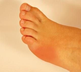 Emilie Nereng feet photo 6