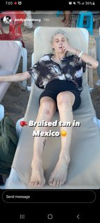 Emily Armstrong feet photo thumbnail