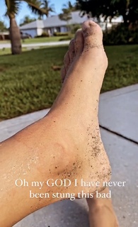 Emily Zeck feet photo 15