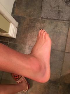 Erin Lim feet photo thumbnail