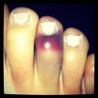 Erin McNaught feet photo 5