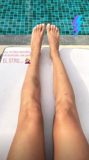Esther Acebo feet photo thumbnail