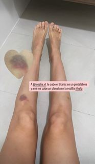 Esther Acebo feet photo 3
