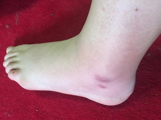 Evelien Smolders feet photo 1