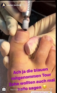 Evelyn Burdecki feet photo thumbnail