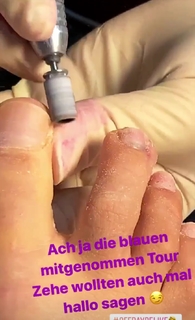 Evelyn Burdecki feet photo thumbnail