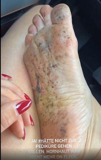 Evelyn Burdecki feet photo thumbnail