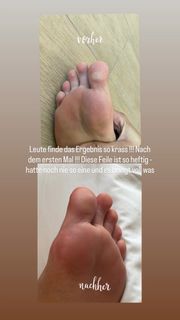 Fata Hasanovic feet photo 5