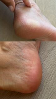 Fata Hasanovic feet photo 2