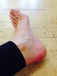 Faye Brookes feet photo 18