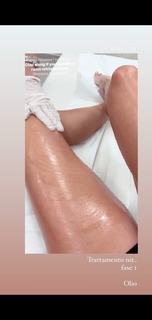 Federica Fontana feet photo thumbnail