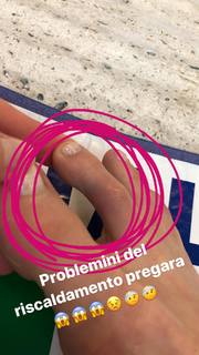 Federica Pellegrini feet photo thumbnail