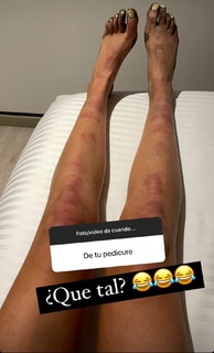 Ferny Graciano feet photo 7