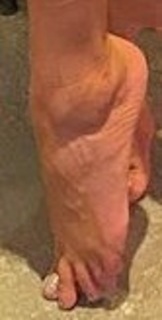 Floppy Tesouro feet photo 19