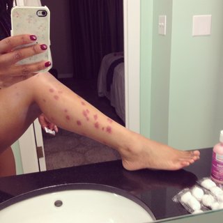 Freema Agyeman feet photo thumbnail