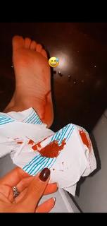 Giorgia Crivello feet photo thumbnail