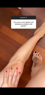 Giorgia Crivello feet photo thumbnail