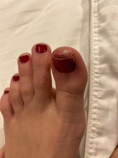 Giovanna Chaves feet photo thumbnail