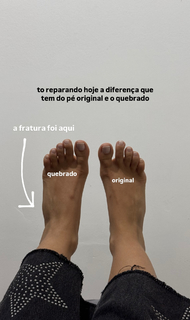 Giovanna Lima feet photo 16