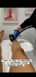 Hammasa Kohistani feet photo thumbnail