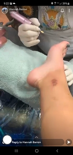 Hannah Barron feet photo thumbnail