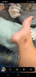 Hannah Barron feet photo thumbnail