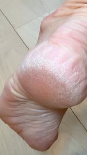 Heidi D'Amelio feet photo thumbnail