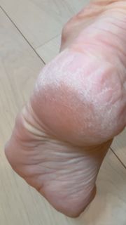 Heidi D'Amelio feet photo 1