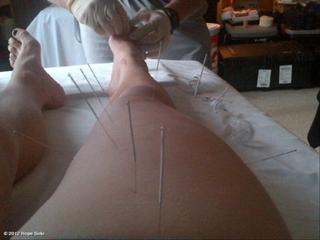 Hope Solo feet photo thumbnail