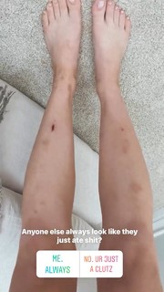 Hunter King feet photo thumbnail