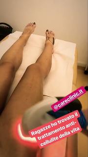 Iaia de Rose feet photo 10