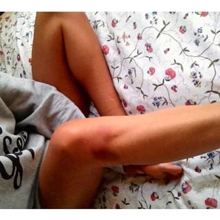 Ilfenesh Hadera feet photo thumbnail