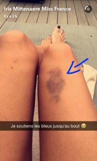 Iris Mittenaere feet photo thumbnail