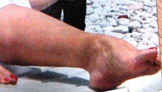 Ivana Banfic feet photo 2