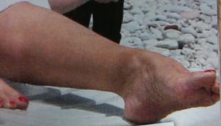 Ivana Banfic feet photo 1
