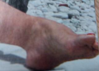 Ivana Banfic feet photo 19