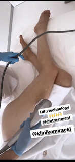 Izabella Miko feet photo thumbnail