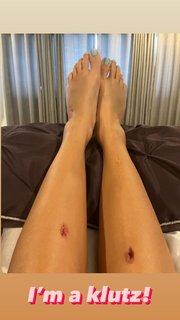 Jacey Birch feet photo thumbnail