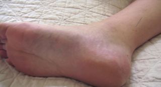 Jacinda Ardern feet photo thumbnail