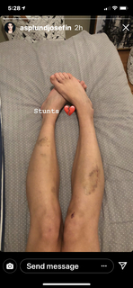 Josefin Asplund feet photo 4