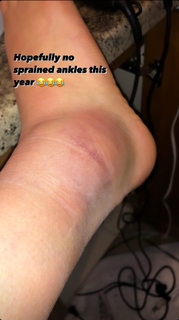 Kalani Hilliker feet photo thumbnail