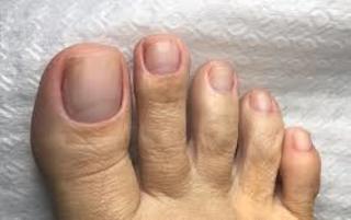 Karin Klemp feet photo thumbnail