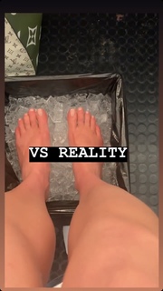 Karlie Kloss feet photo thumbnail