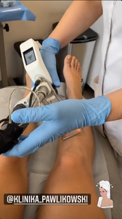 Karolina Kowalkiewicz feet photo thumbnail