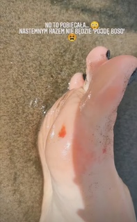 Karolina Pisarek feet photo thumbnail