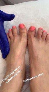Katarzyna Cichopek feet photo thumbnail