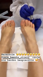 Katarzyna Cichopek feet photo thumbnail